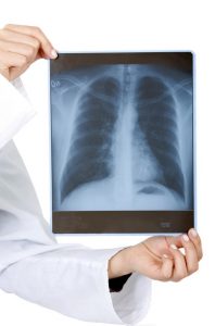 Nowa technika pomocna w diagnostyce astmy i POChP
